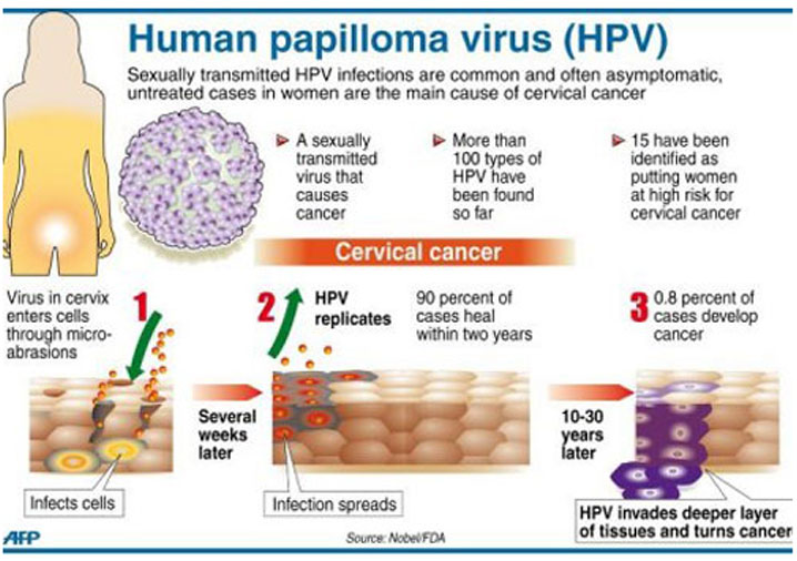 宫颈癌自述，HPV病毒是最
